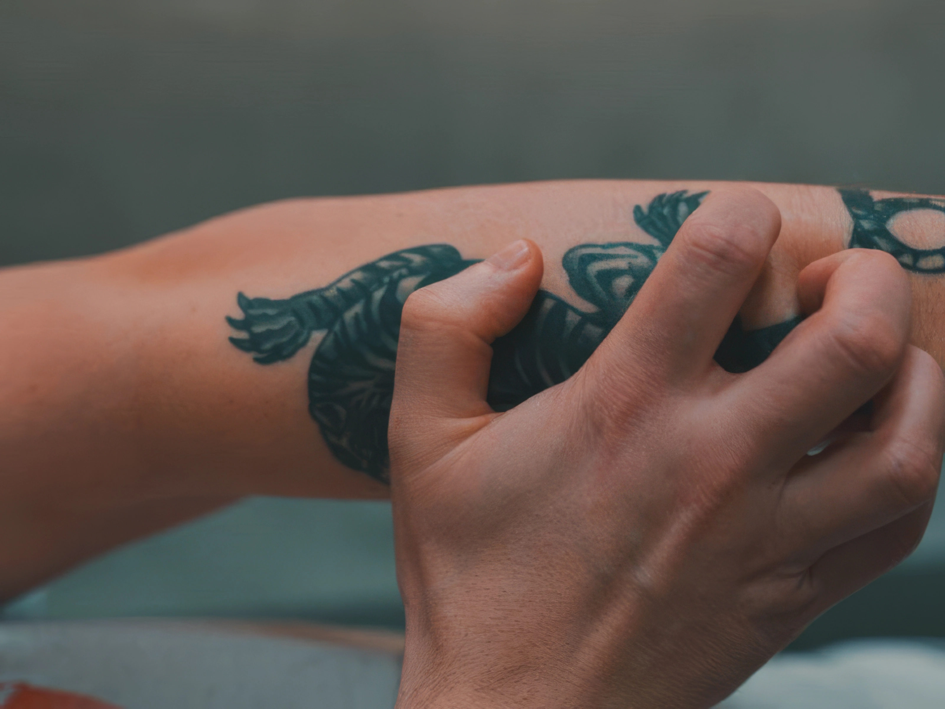 allergic reaction to tattoo ink