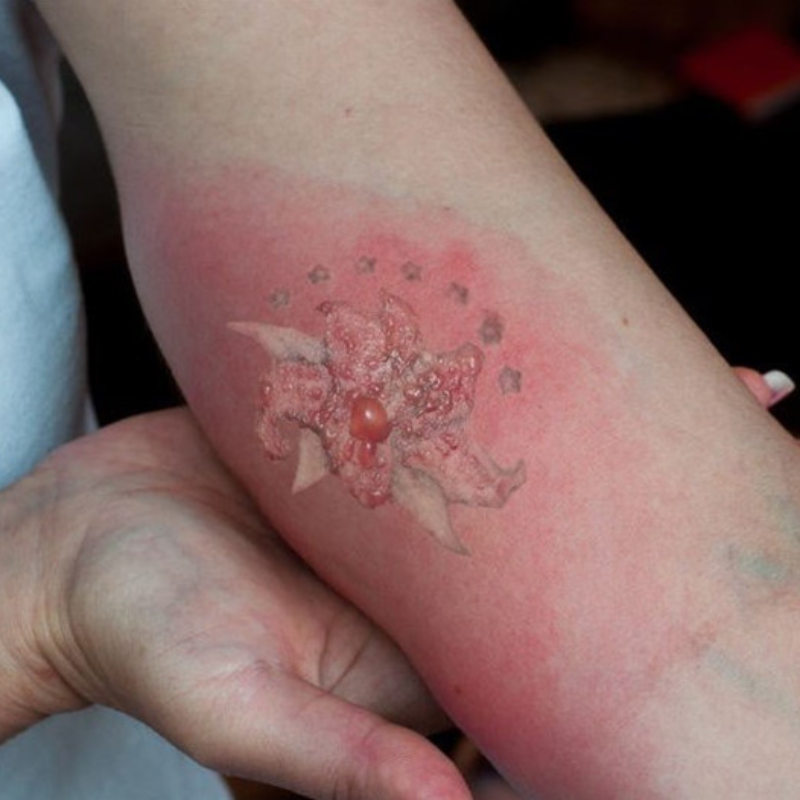 Có thể uống bia sau xăm được không?