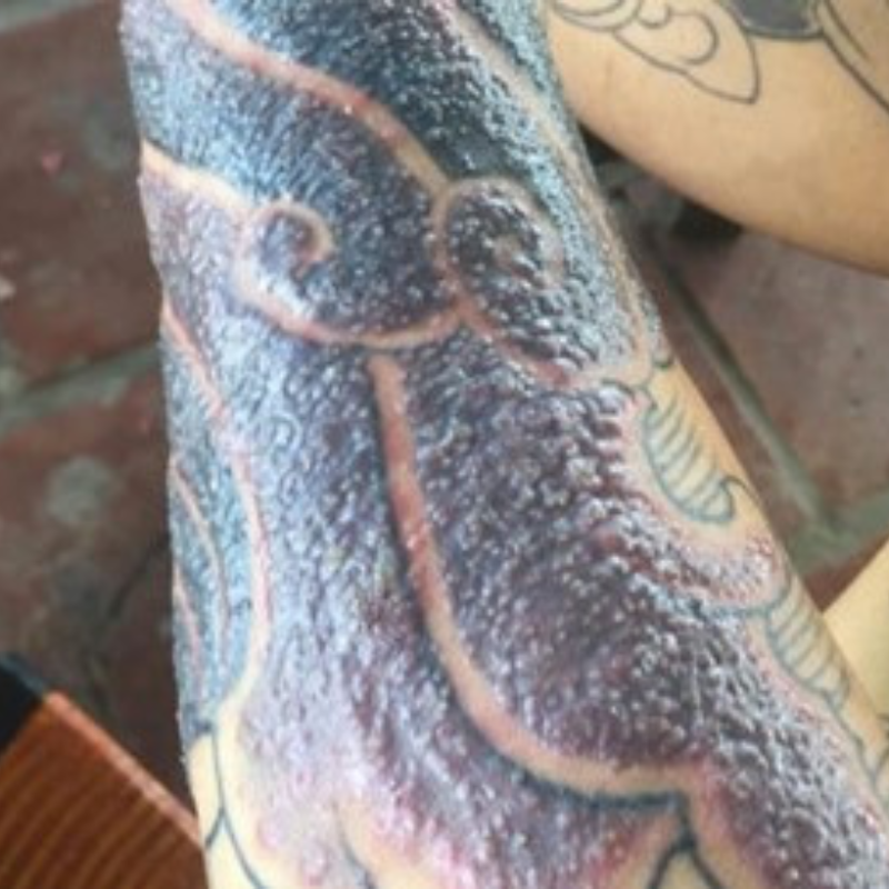 Bôi Kem Chống Nắng Lên Hình Xăm Đang Lành Có Được Không?