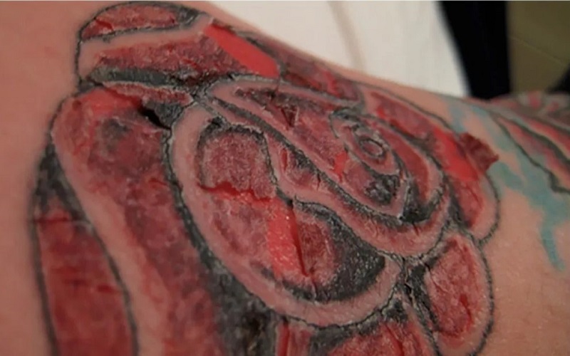 Dưỡng ẩm hình xăm bằng gì