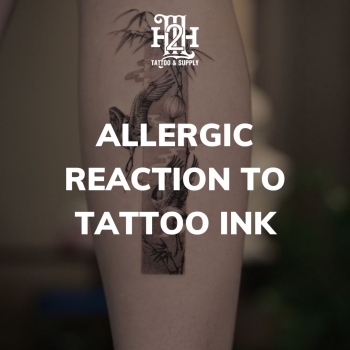 Phản Ứng Dị Ứng Mực Xăm: 8 Dấu Hiệu, Cách Điều Trị Và Phòng Ngừa Cần Thiết