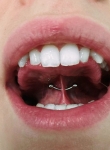 Xỏ Khuyên Miệng: Các Vị Trí, Quy Trình & Chăm Sóc Đúng Cách