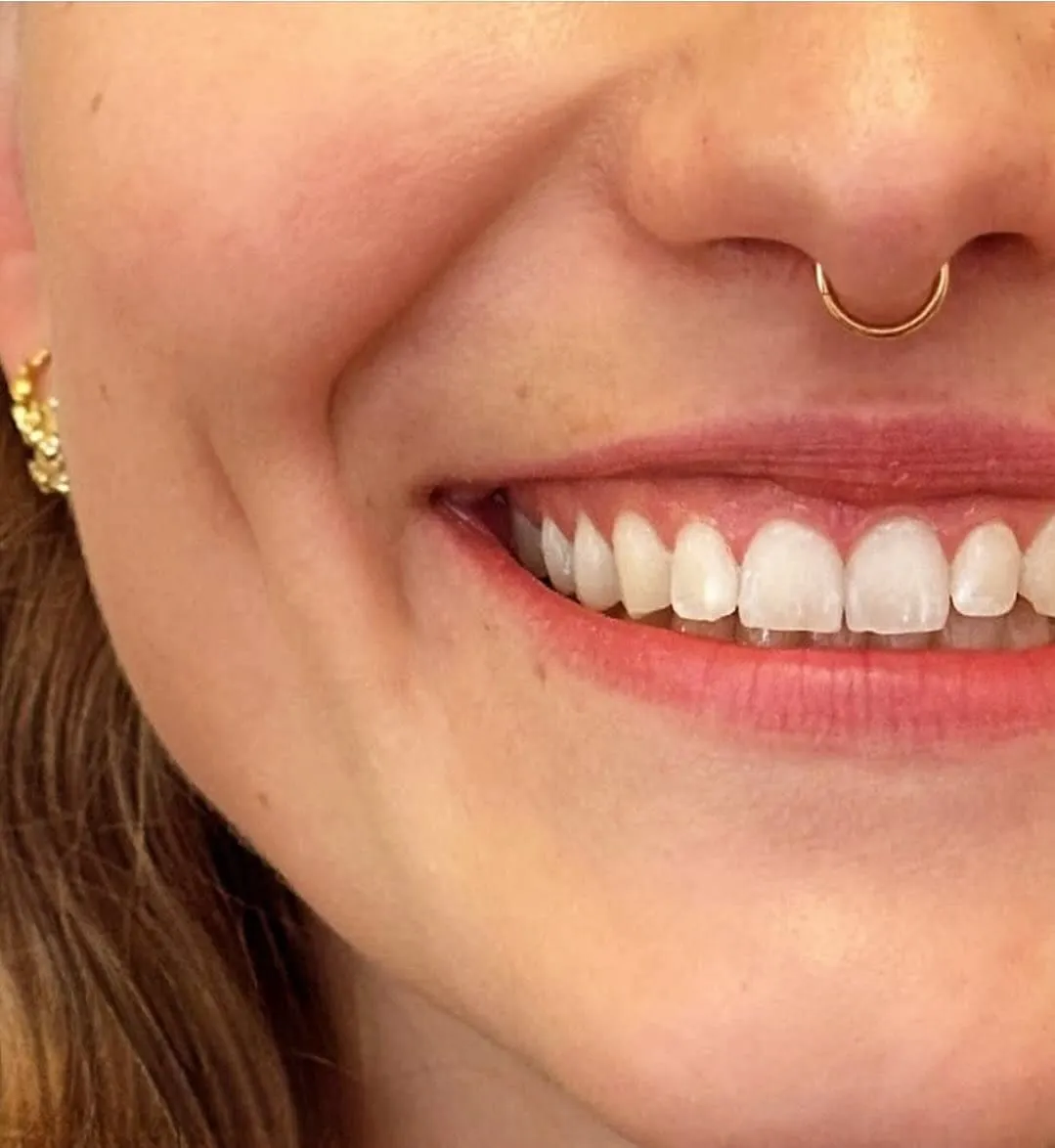 Xỏ Khuyên Septum Là Gì? Toàn Bộ Kinh Nghiệm Từ A-Z Bạn Cần Biết